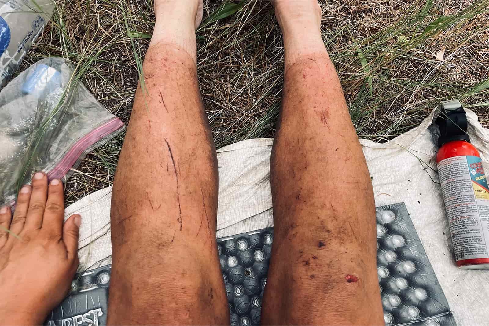 A hikers legs are shown stretched out on a sleeping pad with bear spray on one side and a water filter on the other. They are dirty with many scratches covering them.